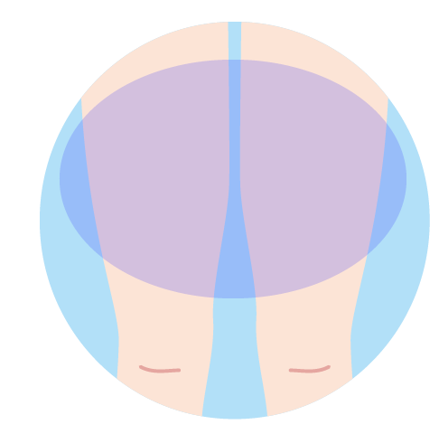 両ひざ上