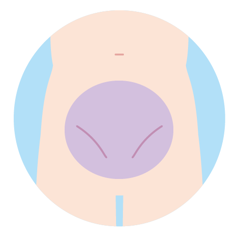 Vライン
